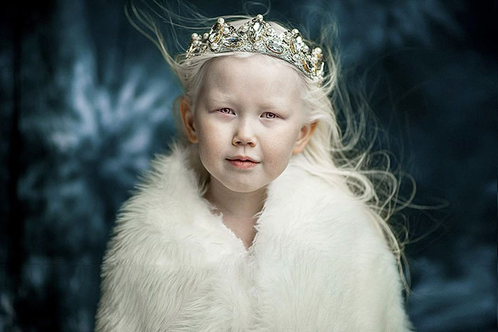 'Branca de Neve siberiana', albina de 8 anos recebe convites para ser modelo