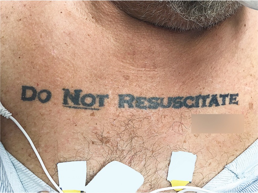 Tatuagem diz "não reanimar"