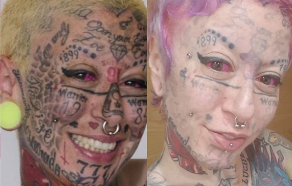 Mulher decide tirar 270 tatuagens