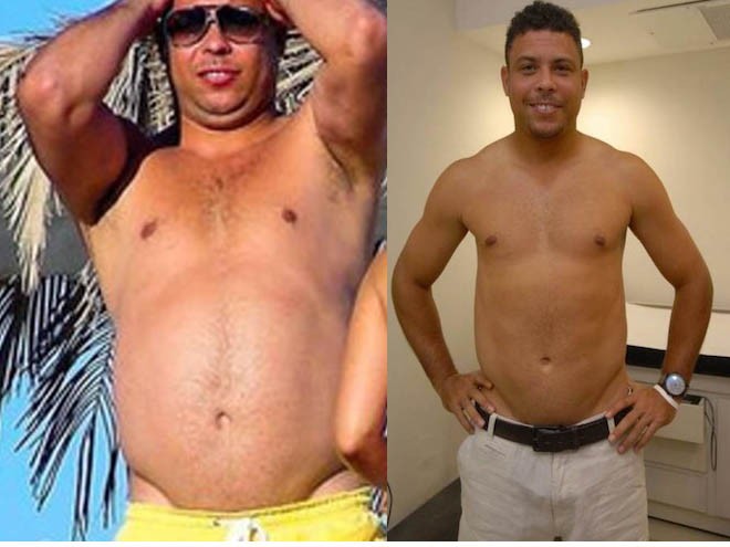 Ronaldo antes e depois do 