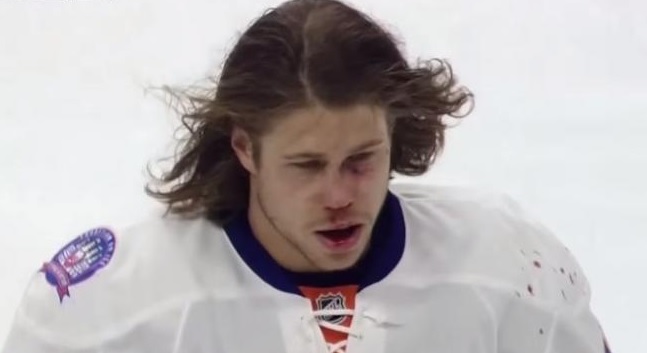 Martin, do NY Islanders, saiu do gelo com o nariz quebrado, mas voltou para o jogo
