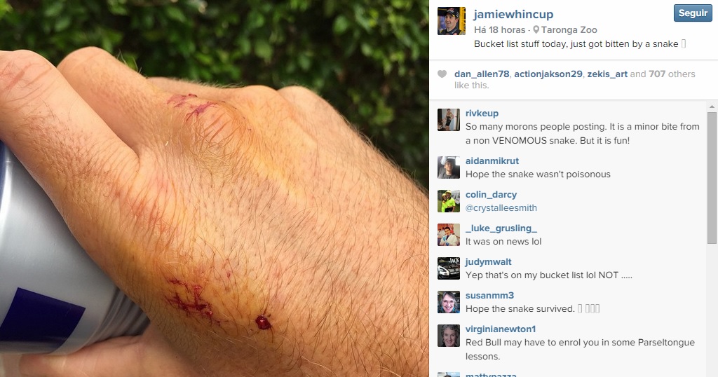 Whincup mostra a mão machucada após o incidente com a cobra