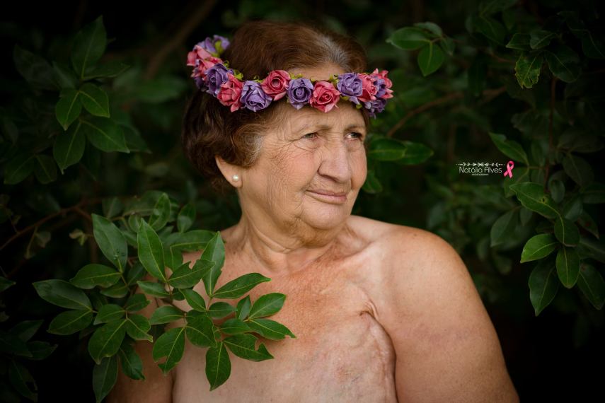 Dona Aurora venceu as sequelas de um erro médico e as cicatrizes de duas mastectomias. Sua neta, a fotógrafa Natália Alves, decidiu homenageá-la com esse álbum especial que ganhou as redes sociais <3