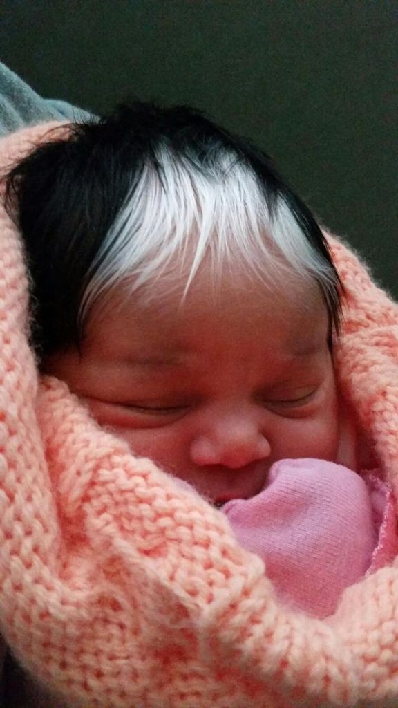 As mulheres da família Worthy carregam a mesma condição genética: poliose. Agora, a bebê MilliAnna é mais uma com a faixa esbranquiçada de cabelos que tanto lembra a Cruella De Vil.