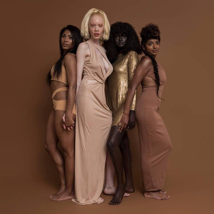 Essa é Diandra Forrest, modelo albina com descendência africana. Apesar do preconceito, Diandra se firmou como uma das maiores apostas do mundo da moda nos últimos anos. Apenas maravilhosa!