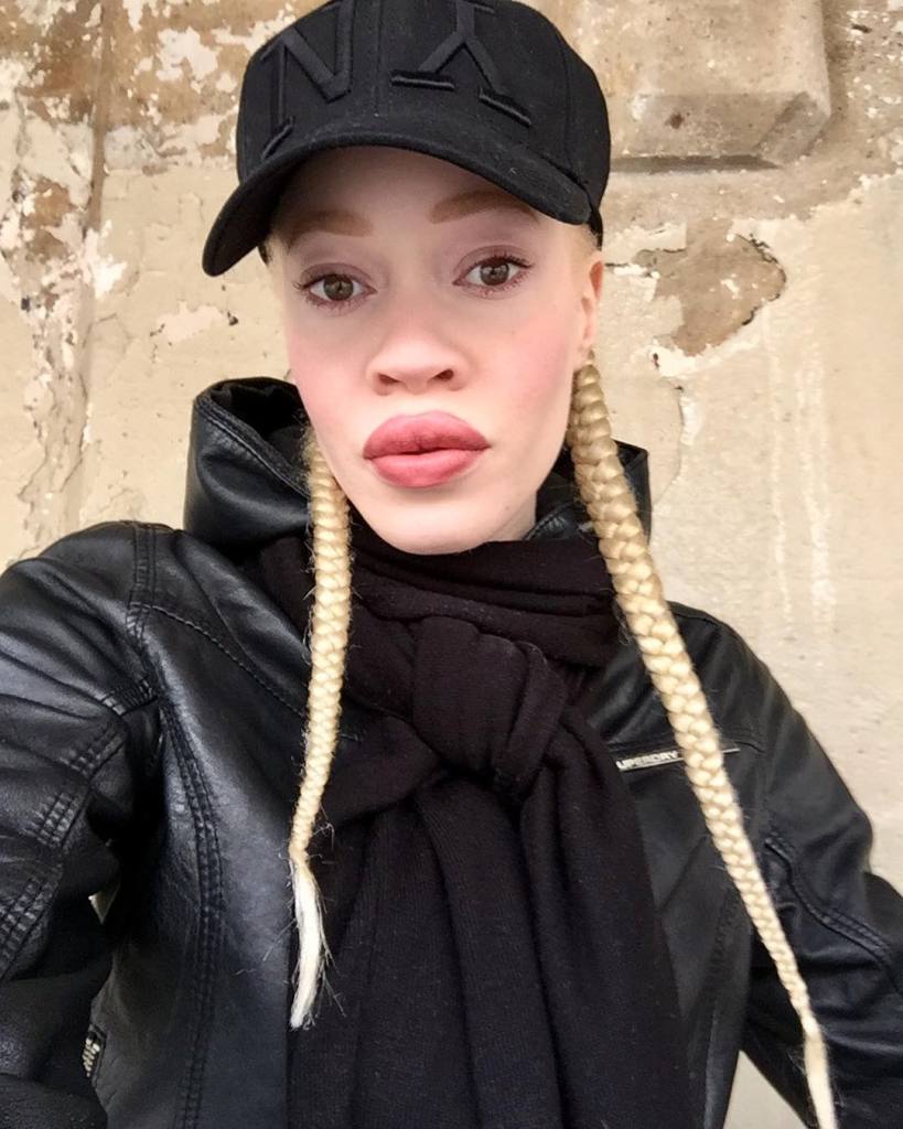Essa é Diandra Forrest, modelo albina com descendência africana. Apesar do preconceito, Diandra se firmou como uma das maiores apostas do mundo da moda nos últimos anos. Apenas maravilhosa!