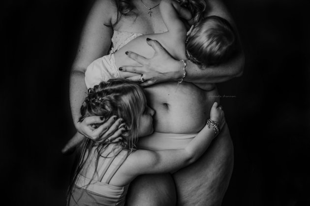 Para a fotógrafa Mikaela Shannon, as mudanças que acompanham o nascimento de uma criança merecem ser celebradas - principalmente as que ficam na pele