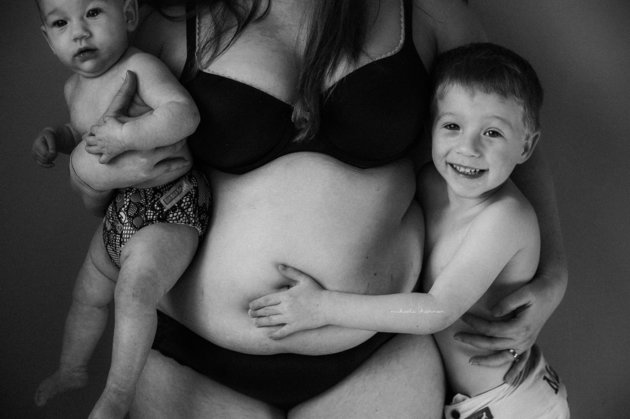 Para a fotógrafa Mikaela Shannon, as mudanças que acompanham o nascimento de uma criança merecem ser celebradas - principalmente as que ficam na pele