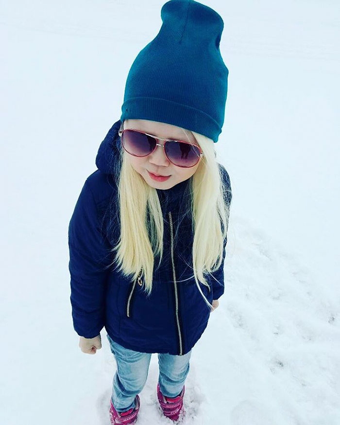 'Branca de Neve siberiana', albina de 8 anos recebe convites para ser modelo