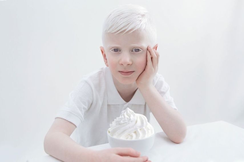 Fotógrafa retrata albinos como anjos