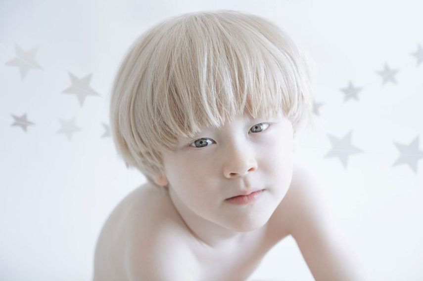 Fotógrafa retrata albinos como anjos