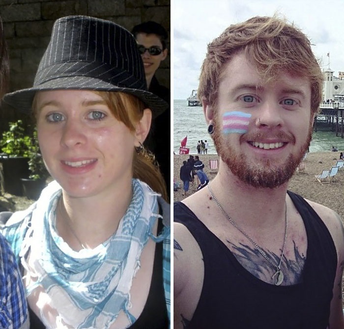Esses antes e depois mostram 50 pessoas que passaram por transição de gênero