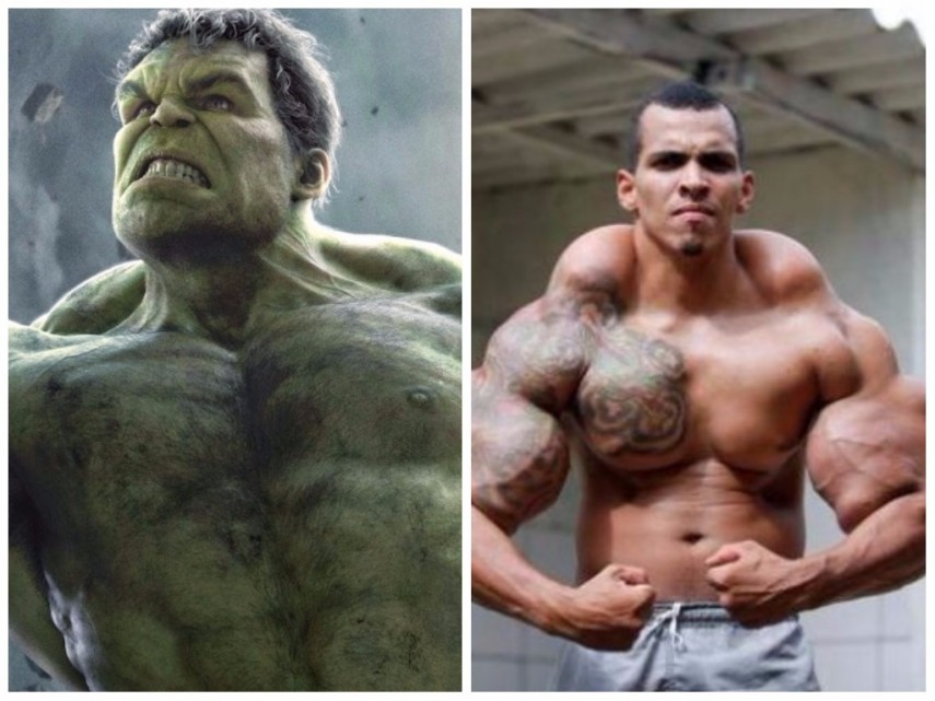  E olha o Brasil na list! Romario Dos Santos Alves quer ser ninguem menos do que Hulk. Ele injetou sozinho sython para ficar musculoso como o personagem. A gente nem precisa dizer que isso não é certo, né?