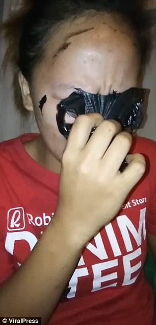 Garota perde sobrancelhas com uso incorreto de máscara contra cravos