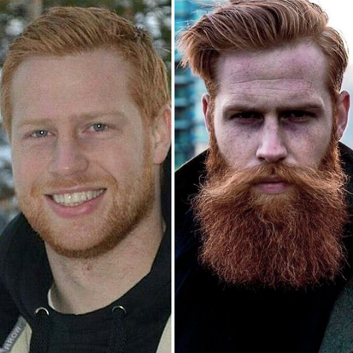 Gwilyn Pugh viu sua vida mudar depois de aceitar uma sugestão de um barbeiro para deixar a barba crescer. O rapaz tímido acabou virando um modelo de sucesso!