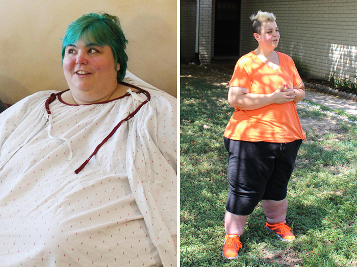 Antes e depois de pessoas que eliminaram muito peso