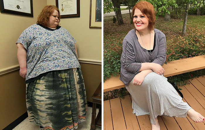 Antes e depois de pessoas que eliminaram muito peso