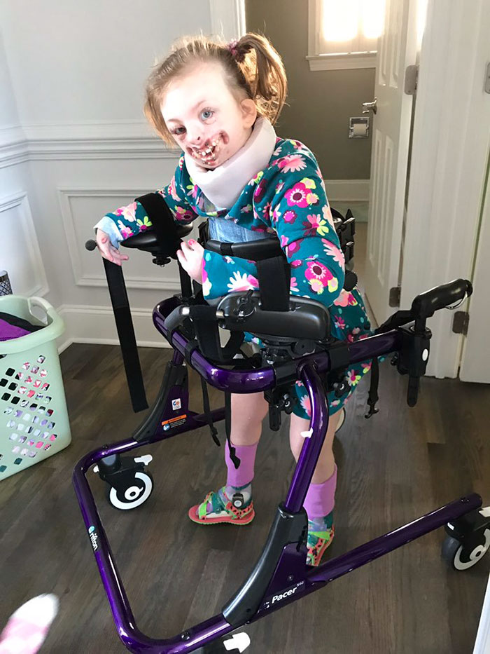 Menina de 9 anos com deficiência se torna símbolo de campanha contra ódio