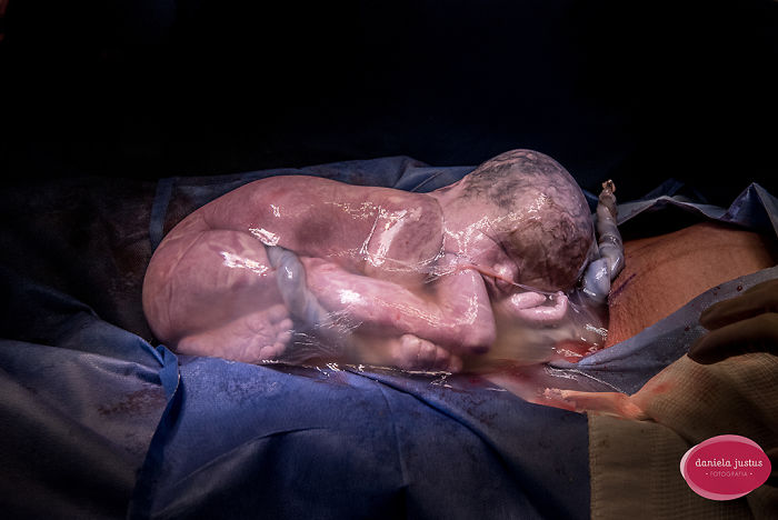 Fotos de nascimentos mostram como as mulheres são duronas