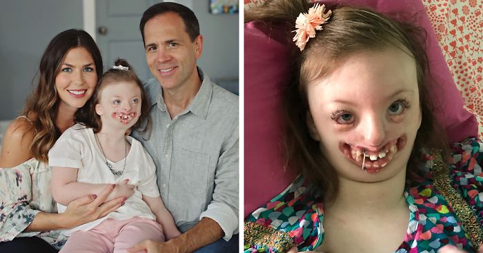 Menina de 9 anos com deficiência se torna símbolo de campanha contra ódio