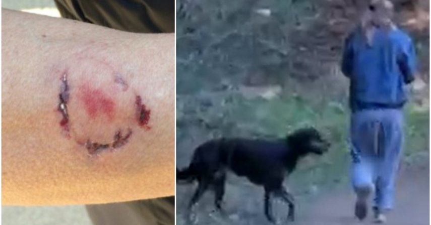 Mulher é atacada por cão e mordida por dona do animal