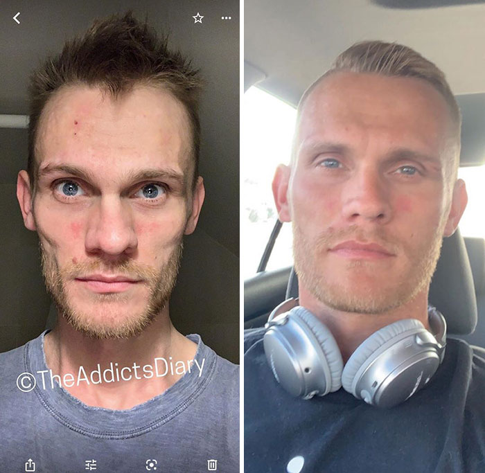 Imagens mostram antes e depois de pessoas se livrarem das drogas