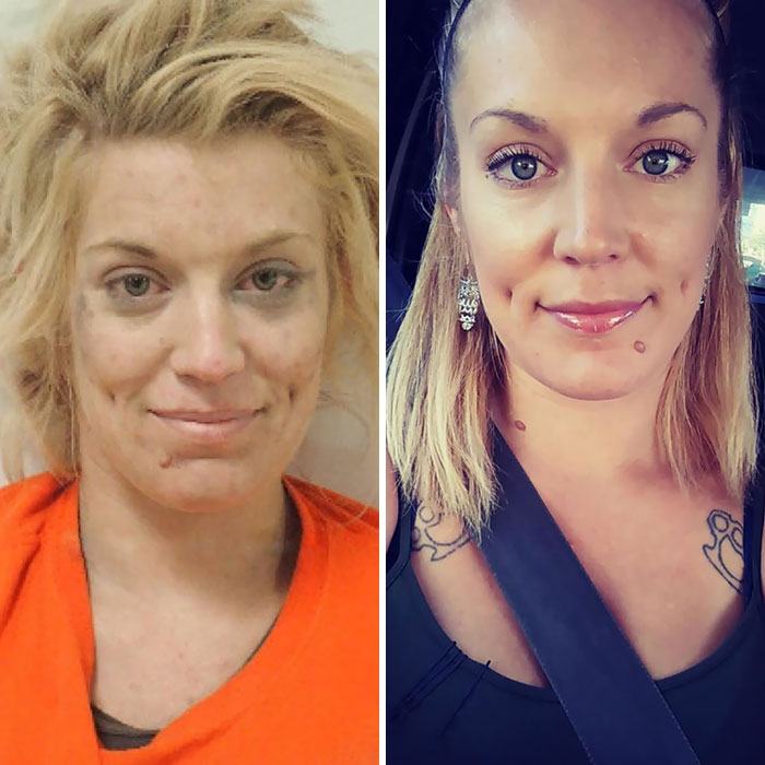 Imagens mostram antes e depois de pessoas se livrarem das drogas