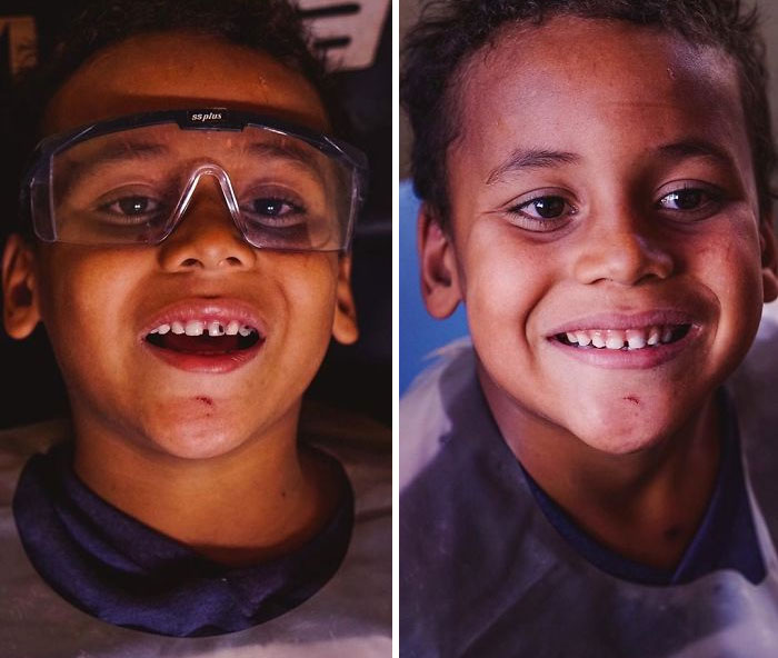 Dentista brasileiro viaja o mundo dando de volta o sorriso das pessoas