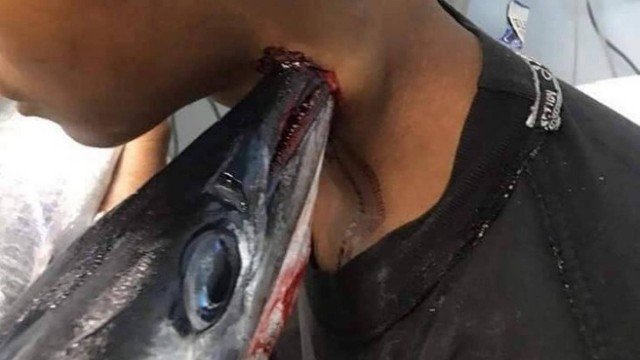 Peixe-agulha atravessou pescoço do adolescente, que ainda se salvou