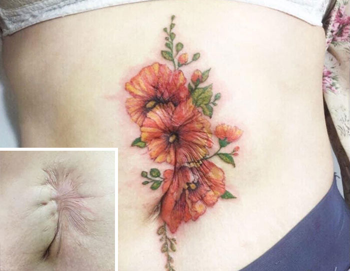 Artista transforma cicatrizes em belas tatuagens